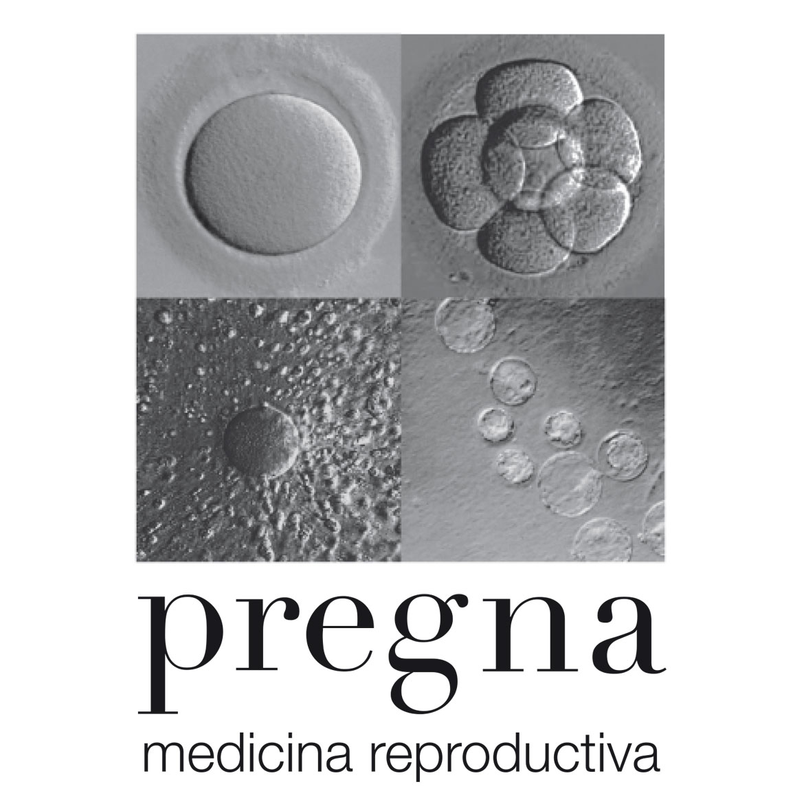 Pregna